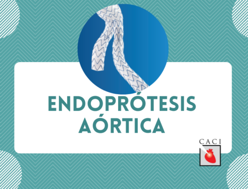 Endoprótesis aórtica