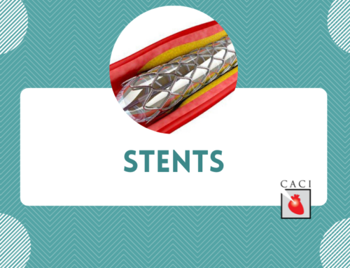 Stents