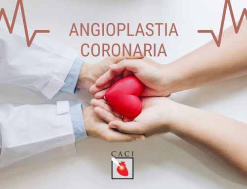 Angioplastia coronaria