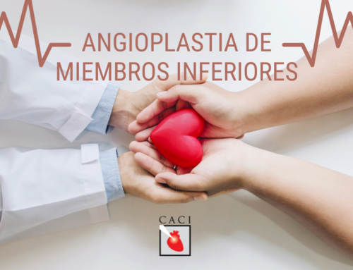 Angioplastia de miembros inferiores