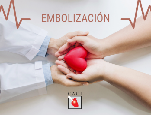 Embolización